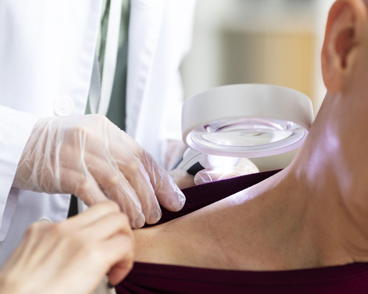 Atendimento em Cirurgia Dermatológica